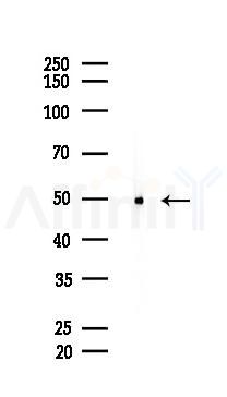 Pim-1 Antibody - Western blot analysis of lysates from EC304 cells(starvation,24h treatment), using Pim-1 Antibody at 1/1000 dilution.