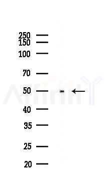 Pim-1 Antibody - Western blot analysis of lysates from HUVEC cells(starvation,24h treatment), using Pim-1 Antibody at 1/1000 dilution.