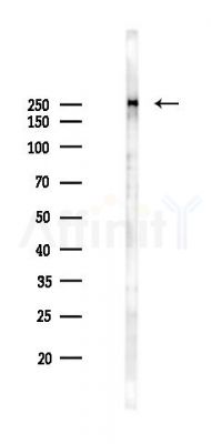 CREB-BP Antibody - Western blot analysis of lysates from PC12 cells(LPS 4h treatment), using CREB-BP Antibody at 1/1000 dilution.