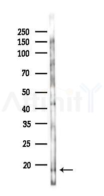 Histone H4 Antibody - Western blot analysis of lysates from K562 cells(UV,30min treatment), using Histone H4 Antibody at 1/1000 dilution.