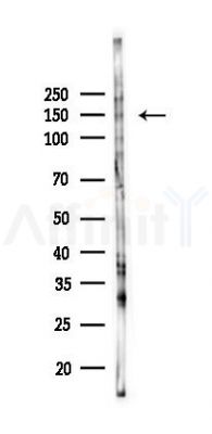 Phospho-c-Kit (Tyr721) Antibody - Western blot analysis of lysates from K562 cells(UV,30min treatment), using Phospho-c-Kit (Tyr721) Antibody at 1/1000 dilution.