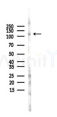Phospho-GAB1 (Tyr307) Antibody - Western blot analysis of lysates from K562 cells(UV 30min treatment), using Phospho-GAB1 (Tyr307) Antibody at 1/1000 dilution.