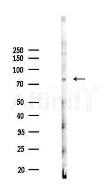 Phospho-HSL (Ser563)[Ser853] Antibody - Western blot analysis of lysates from Rat brain, using Phospho-HSL (Ser563)[Ser853] Antibody at 1/1000 dilution.