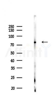 Phospho-HSL (Ser563)[Ser853] Antibody - Western blot analysis of lysates from Mouse testis, using Phospho-HSL (Ser563)[Ser853] Antibody at 1/1000 dilution.