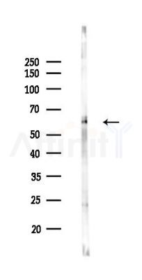 Phospho-MST1(Thr183)/MST2(Thr180) Antibody - Western blot analysis of lysates from Rat brain, using Phospho-MST1(Thr183)/MST2(Thr180) Antibody at 1/1000 dilution.