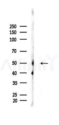Phospho-IRF3 (Ser396) Antibody - Western blot analysis of lysates from Mouse liver, using Phospho-IRF3 (Ser396) Antibody at 1/1000 dilution.