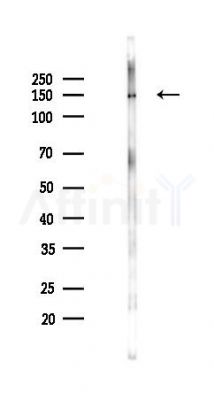 AS160 Antibody - Western blot analysis of lysates from Rat brain, using AS160 Antibody at 1/1000 dilution.