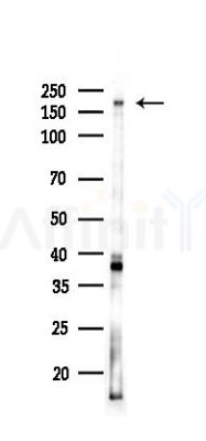 BCL9L Antibody - Western blot analysis of lysates from K562 cells(UV,30min treatment), using BCL9L Antibody at 1/1000 dilution.