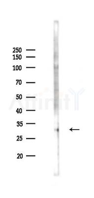 DARPP32 Antibody - Western blot analysis of lysates from PC12 cells(LPS 4h treatment), using DARPP32 Antibody at 1/1000 dilution.