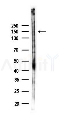 PTP alpha Antibody - Western blot analysis of lysates from K562 cells(UV,30min treatment), using PTP alpha Antibody at 1/1000 dilution.