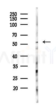 Phospho-Chk1 (Ser286) Antibody - Western blot analysis of lysates from PC12 cells(LPS 4h treatment), using Phospho-Chk1 (Ser286) Antibody at 1/1000 dilution.