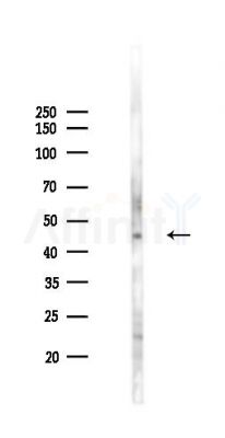 Phospho-Aurora A (Thr288) Antibody - Western blot analysis of lysates from PC12 cells(LPS 4h treatment), using Phospho-Aurora A (Thr288) Antibody at 1/1000 dilution.