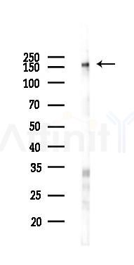 Phospho-EGFR (Tyr992)[Tyr1016] Antibody - Western blot analysis of lysates from Hela cells(LPS 4h treatment), using Phospho-EGFR (Tyr992)[Tyr1016] Antibody at 1/1000 dilution.