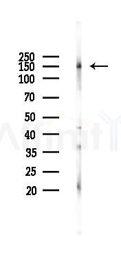 Phospho-EGFR (Tyr1086)[Tyr1110] Antibody - Western blot analysis of lysates from Rat brain, using Phospho-EGFR (Tyr1086)[Tyr1110] Antibody at 1/1000 dilution.
