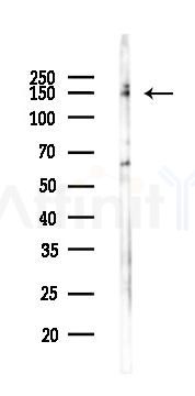 Phospho-EGFR (Ser1071) Antibody - Western blot analysis of lysates from Hela cells(LPS 4h treatment), using Phospho-EGFR (Ser1071) Antibody at 1/1000 dilution.