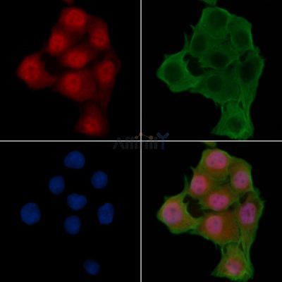 Phospho-Estrogen Receptor alpha (Ser104) Antibody - AF3059 staining Hela cells(24h of starvation treatment) by IF/ICC.
