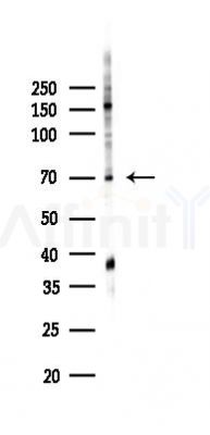 Phospho-C-RAF (Ser621) Antibody - Western blot analysis of lysates from K562 cells(UV,30min treatment), using Phospho-C-RAF (Ser621) Antibody at 1/1000 dilution.