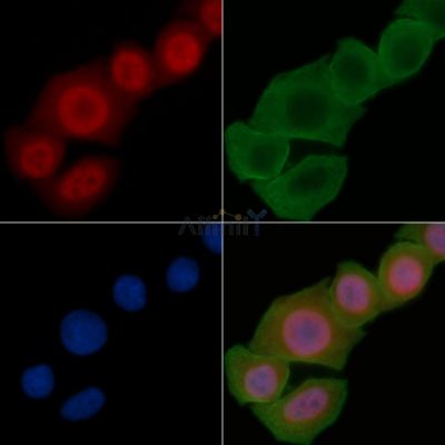 Phospho-Tyrosine Hydroxylase (Ser40) Antibody - AF3114 staining Hela cells(24h of starvation treatment) by IF/ICC.