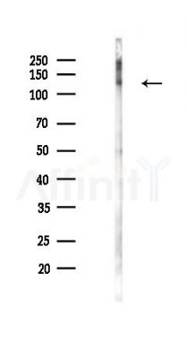 Phospho-c-Met (Tyr1003) Antibody - Western blot analysis of lysates from PC12 cells(LPS 4h treatment), using Phospho-c-Met (Tyr1003) Antibody at 1/1000 dilution.