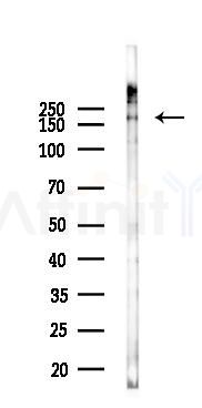 Phospho-PDGF Receptor beta (Tyr740) Antibody - Western blot analysis of lysates from EC304 cells(starvation 24h treatment), using Phospho-PDGF Receptor beta (Tyr740) Antibody at 1/1000 dilution.
