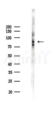 Phospho-Tau (Ser214) Antibody - Western blot analysis of lysates from PC12 cells(LPS 4h treatment), using Phospho-Tau (Ser214) Antibody at 1/1000 dilution.