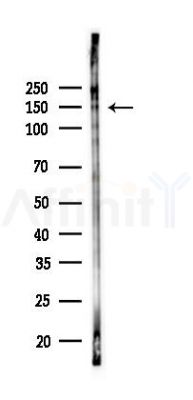 Phospho-c-Kit (Tyr703) Antibody - Western blot analysis of lysates from K562 cells(UV,30min treatment), using Phospho-c-Kit (Tyr703) Antibody at 1/1000 dilution.