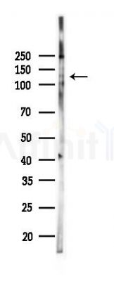 Phospho-c-Kit (Tyr721) Antibody - Western blot analysis of lysates from K562 cells(UV,30min treatment), using Phospho-c-Kit (Tyr721) Antibody at 1/1000 dilution.
