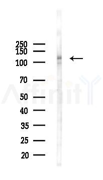 Phospho-FGFR1 (Tyr654) Antibody - Western blot analysis of lysates from Hela cells(starvation 24h treatment), using Phospho-FGFR1 (Tyr654) Antibody at 1/1000 dilution.