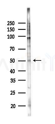Phospho-Src (Tyr419) Antibody - Western blot analysis of lysates from K562 cells(UV,30min treatment), using Phospho-Src (Tyr419) Antibody at 1/1000 dilution.