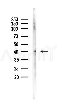Phospho-GATA1 (Ser142) Antibody - Western blot analysis of lysates from Rat brain, using Phospho-GATA1 (Ser142) Antibody at 1/1000 dilution.
