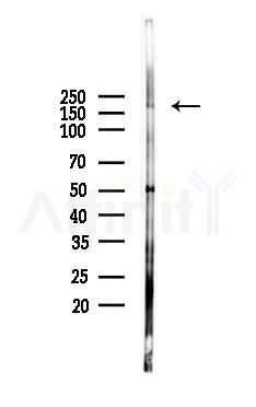 Phospho-PDGF Receptor alpha (Tyr849) Antibody - Western blot analysis of lysates from Mouse lung, using Phospho-PDGF Receptor alpha (Tyr849) Antibody at 1/1000 dilution.