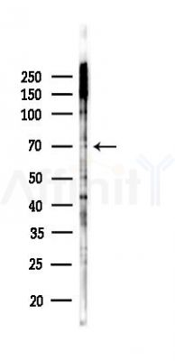 Phospho-PKC-pan (Thr497) Antibody - Western blot analysis of lysates from EC304 cells(starvation 24h treatment), using Phospho-PKC-pan (Thr497) Antibody at 1/1000 dilution.