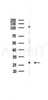 Phospho-TNNI3 (Thr143) Antibody - Western blot analysis of lysates from RAW264.