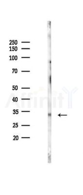 Phospho-Cyclin D1 (Ser90) Antibody - Western blot analysis of lysates from Mouse brain, using Phospho-Cyclin D1 (Ser90) Antibody at 1/1000 dilution.