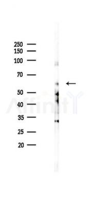 Phospho-PI3K p85 alpha (Tyr607) Antibody - Western blot analysis of lysates from Mouse brain, using Phospho-PI3K p85 alpha (Tyr607) Antibody at 1/1000 dilution.