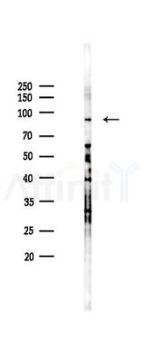 Phospho-PI3K p85 alpha (Tyr607) Antibody - Western blot analysis of lysates from K562 cells(heat-shock 45min treatment), using Phospho-PI3K p85 alpha (Tyr607) Antibody at 1/1000 dilution.