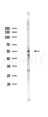 Phospho-SHC (Tyr349) Antibody - Western blot analysis of lysates from K562 cells(heat-shock 45min treatment), using Phospho-SHC (Tyr349) Antibody at 1/1000 dilution.