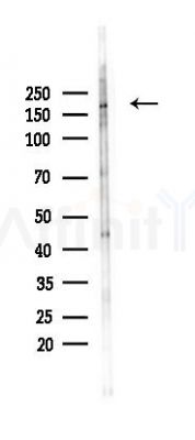 Phospho-eNOS (Ser1177) Antibody - Western blot analysis of lysates from PC12 cells(starvation 24h treatment), using Phospho-eNOS (Ser1177) Antibody at 1/1000 dilution.