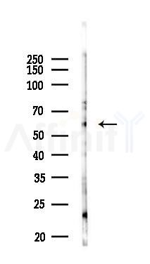 Phospho-pan-AKT1/2/3 (Ser473) Antibody - Western blot analysis of lysates from PC12 cells(LPS 4h treatment), using Phospho-pan-AKT1/2/3 (Ser473) Antibody at 1/1000 dilution.