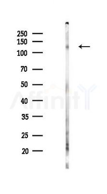 Phospho-VE-Cadherin (Tyr731) Antibody - Western blot analysis of lysates from PC12 cells(LPS 4h treatment), using Phospho-VE-Cadherin (Tyr731) Antibody at 1/1000 dilution.