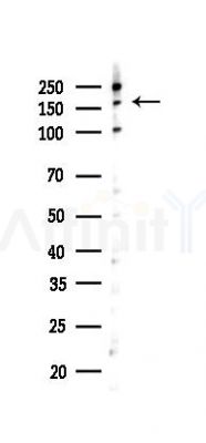 Phospho-IRS1 (Ser307) Antibody - Western blot analysis of lysates from K562 cells(UV,30min treatment), using Phospho-IRS1 (Ser307) Antibody at 1/1000 dilution.