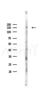 Phospho-VEGFR2 (Tyr1059) Antibody - Western blot analysis of lysates from K562 cells(heat-shock 45min treatment), using Phospho-VEGFR2 (Tyr1059) Antibody at 1/1000 dilution.