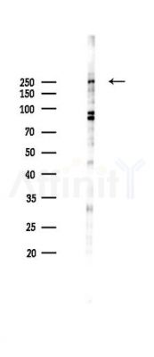 Phospho-mTOR (Thr2446) Antibody - Western blot analysis of lysates from K562 cells(heat-shock 45min treatment), using Phospho-mTOR (Thr2446) Antibody at 1/1000 dilution.