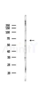 Phospho-ZAP70 (Tyr493) Antibody - Western blot analysis of lysates from PC12 cells(LPS 4h treatment), using Phospho-ZAP70 (Tyr493) Antibody at 1/1000 dilution.