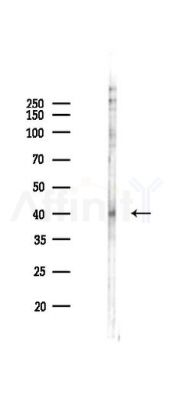 Phospho-JNK1/2/3 (Thr183) Antibody - Western blot analysis of lysates from PC12 cells(LPS 4h treatment), using Phospho-JNK1/2/3 (Thr183) Antibody at 1/1000 dilution.