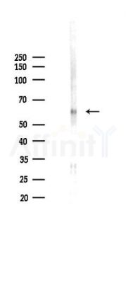 Phospho-JNK1/2/3 (Tyr185) Antibody - Western blot analysis of lysates from Rat liver, using Phospho-JNK1/2/3 (Tyr185) Antibody at 1/1000 dilution.