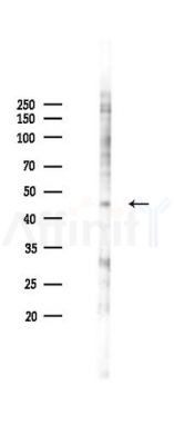 Phospho-JNK1/2/3 (Tyr185) Antibody - Western blot analysis of lysates from K562 cells(heat-shock 45min treatment), using Phospho-JNK1/2/3 (Tyr185) Antibody at 1/1000 dilution.