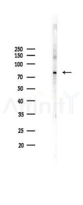 Phospho-SOX9 (Ser181) Antibody - Western blot analysis of lysates from K562 cells(heat-shock 45min treatment), using Phospho-SOX9 (Ser181) Antibody at 1/1000 dilution.