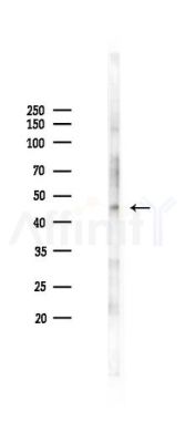 Phospho-VASP (Ser157) Antibody - Western blot analysis of lysates from K562 cells(heat-shock 45min treatment), using Phospho-VASP (Ser157) Antibody at 1/1000 dilution.
