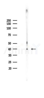 Phospho-VASP (Ser239) Antibody - Western blot analysis of lysates from Mouse brain, using Phospho-VASP (Ser239) Antibody at 1/1000 dilution.